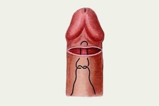hogyan lehet növelni a péniszed